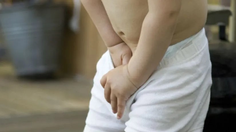 Triệu chứng hẹp bao quy đầu ở trẻ 3 tuổi và cách xử lý